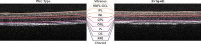 Retinal imaging in animal models: Searching for biomarkers of neurodegeneration